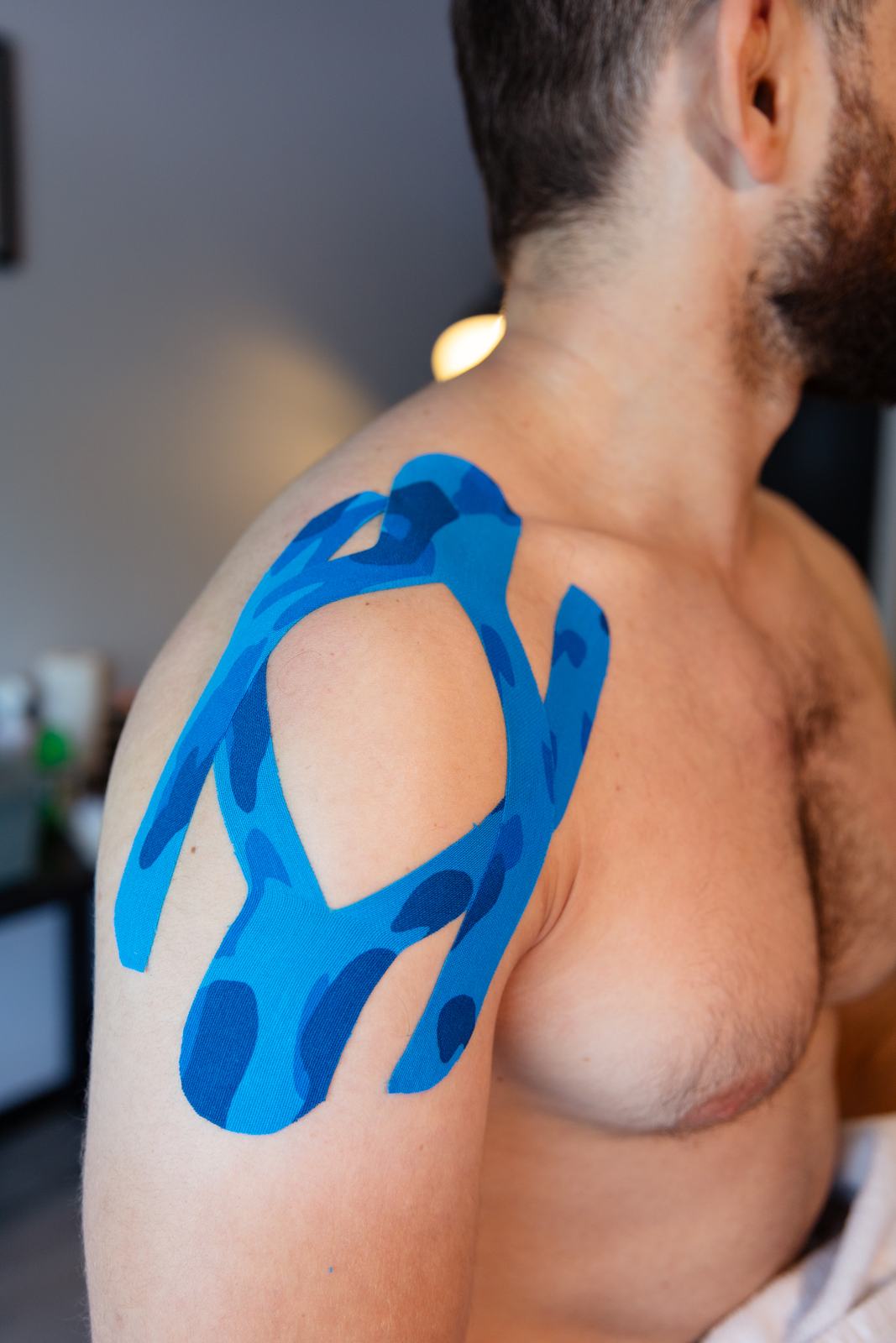 Kinesiology tape applied to a client's shoulder